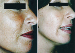 Ennen - J&auml;lkeen